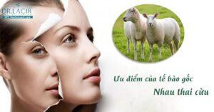 Review sản phẩm Tế Bào Gốc Nhau Thai Cừu Bio Placenta